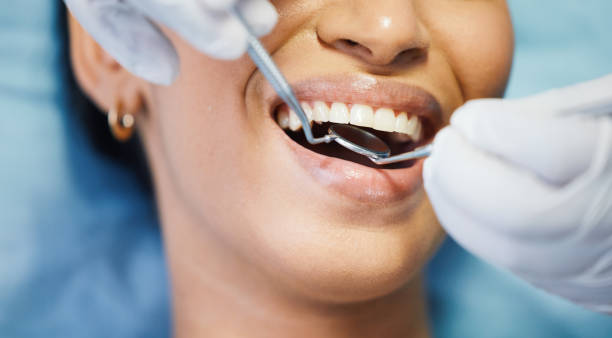 Best Emergency Dental Extractions in Lorain, OH
